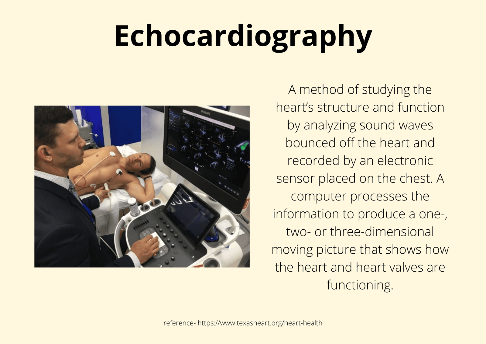 Important Cardiology Terms and Glossary - Cardiopedia